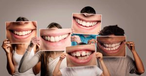 group of happy people holding a picture of a mouth smiling on a gray background - smile makeover