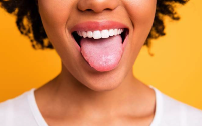 What your tongue tells about your oral health