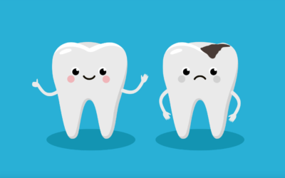 What you need to know about cavities