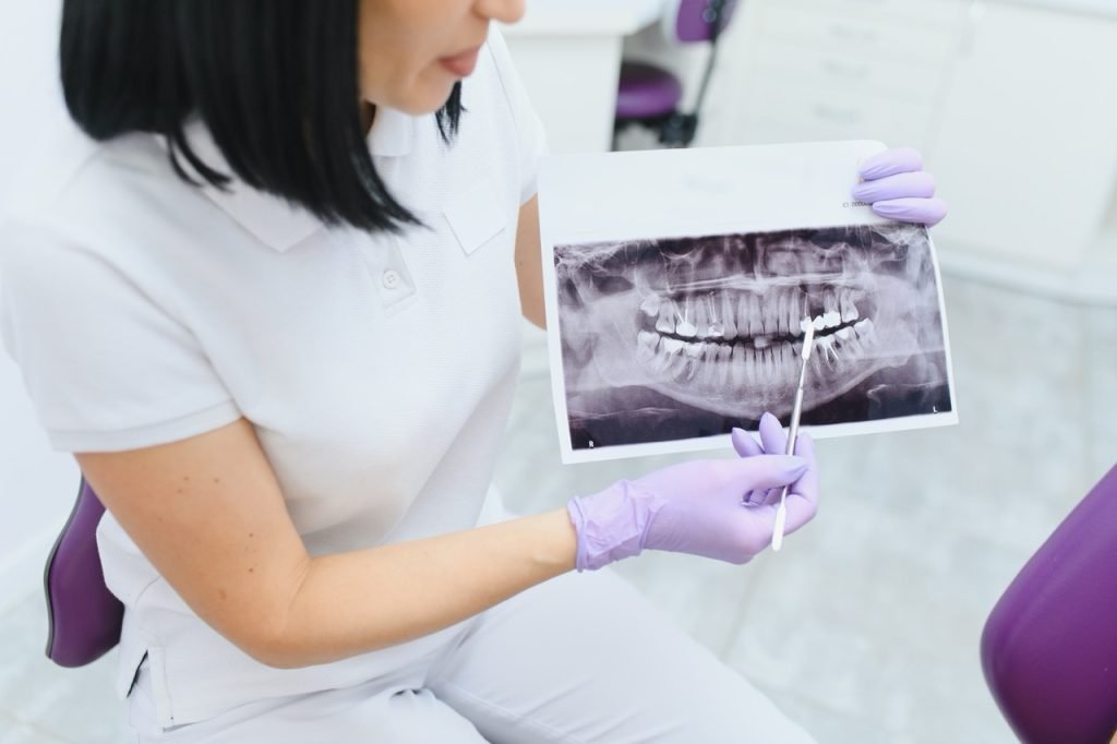 dentist stittsville x ray teeth