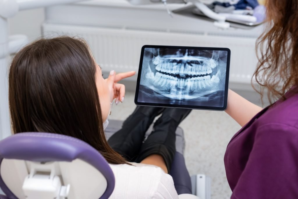 dentist xrays stittsville